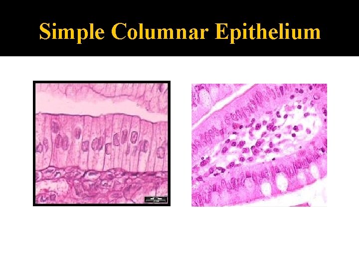 Simple Columnar Epithelium 