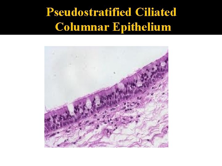 Pseudostratified Ciliated Columnar Epithelium 