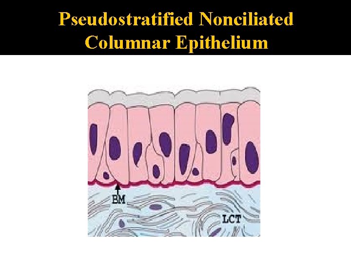 Pseudostratified Nonciliated Columnar Epithelium 
