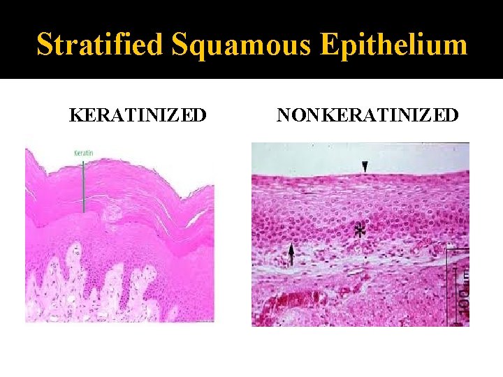 Stratified Squamous Epithelium KERATINIZED NONKERATINIZED 