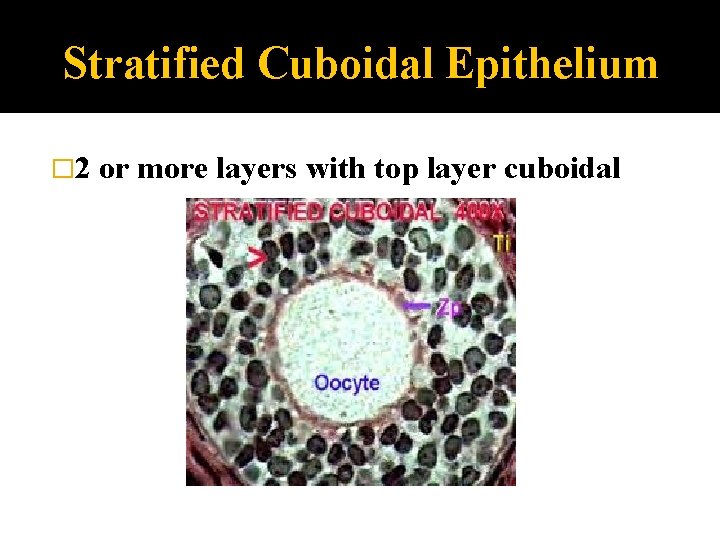 Stratified Cuboidal Epithelium � 2 or more layers with top layer cuboidal 