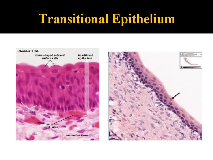 Transitional Epithelium 