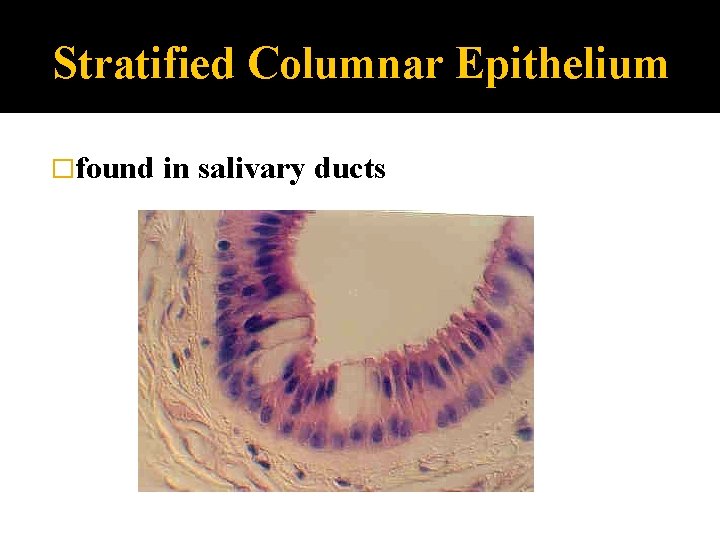 Stratified Columnar Epithelium �found in salivary ducts 