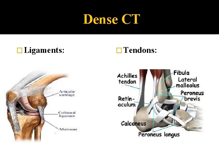 Dense CT � Ligaments: � Tendons: 