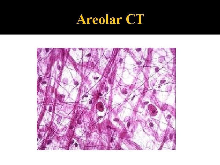 Areolar CT 