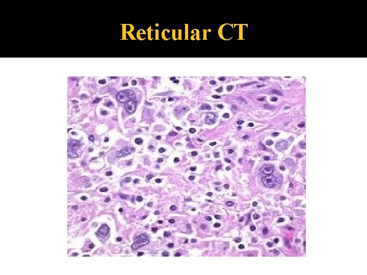 Reticular CT 