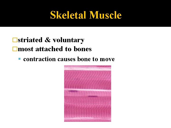 Skeletal Muscle �striated & voluntary �most attached to bones contraction causes bone to move