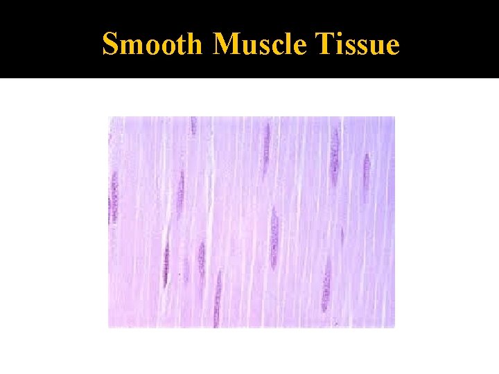 Smooth Muscle Tissue 