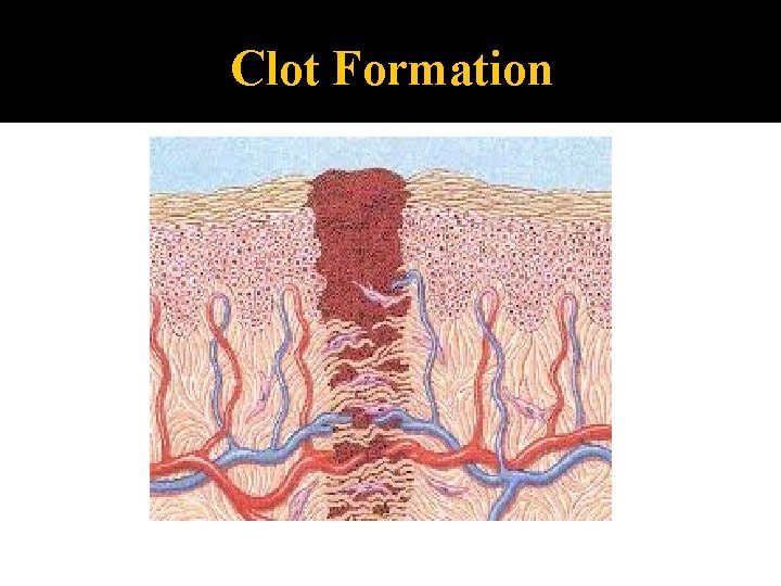 Clot Formation 