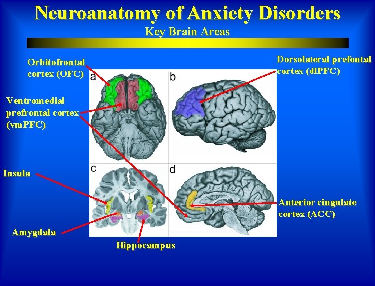 Neuroanatomy of Anxiety Disorders Key Brain Areas Dorsolateral prefontal cortex (dl. PFC) Orbitofrontal cortex