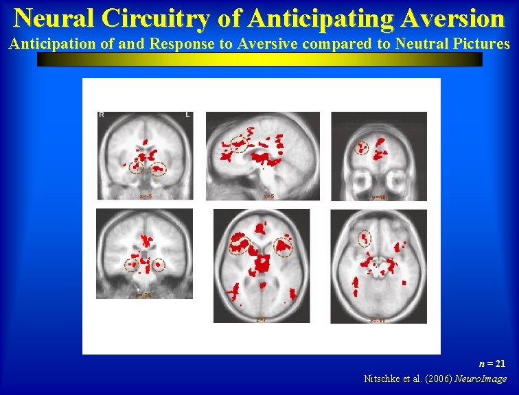 Neural Circuitry of Anticipating Aversion Anticipation of and Response to Aversive compared to Neutral