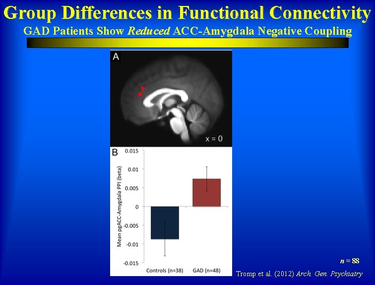 Group Differences in Functional Connectivity GAD Patients Show Reduced ACC-Amygdala Negative Coupling n =