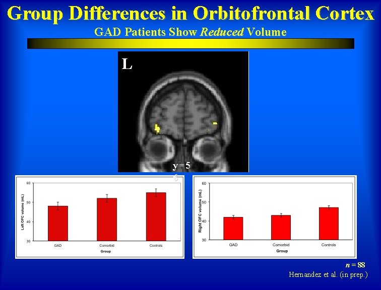 Group Differences in Orbitofrontal Cortex GAD Patients Show Reduced Volume L y=5 6 n