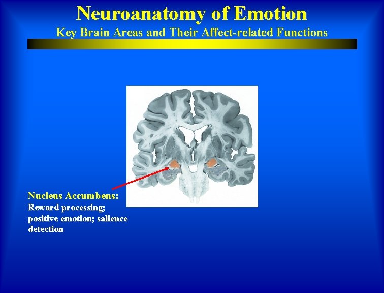 Neuroanatomy of Emotion Key Brain Areas and Their Affect-related Functions Nucleus Accumbens: Reward processing;