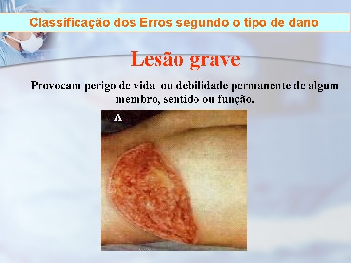 Classificação dos Erros segundo o tipo de dano Lesão grave Provocam perigo de vida