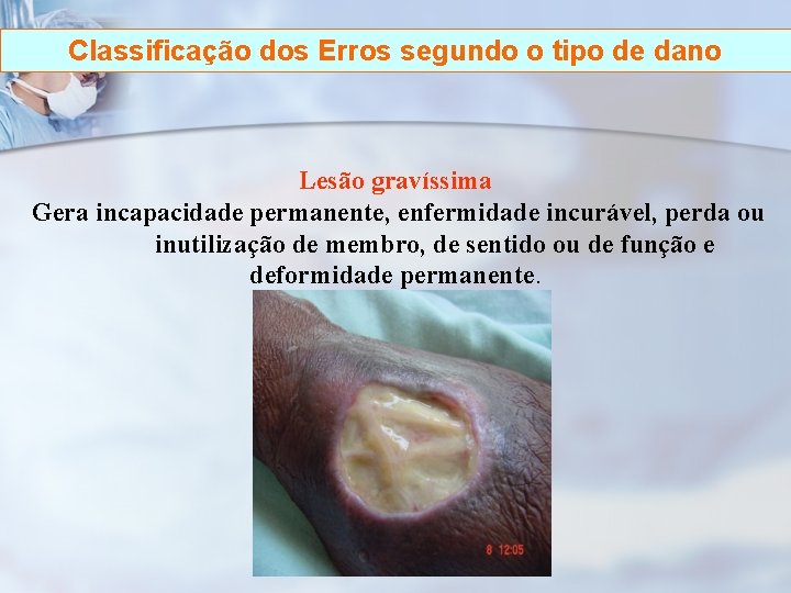 Classificação dos Erros segundo o tipo de dano Lesão gravíssima Gera incapacidade permanente, enfermidade