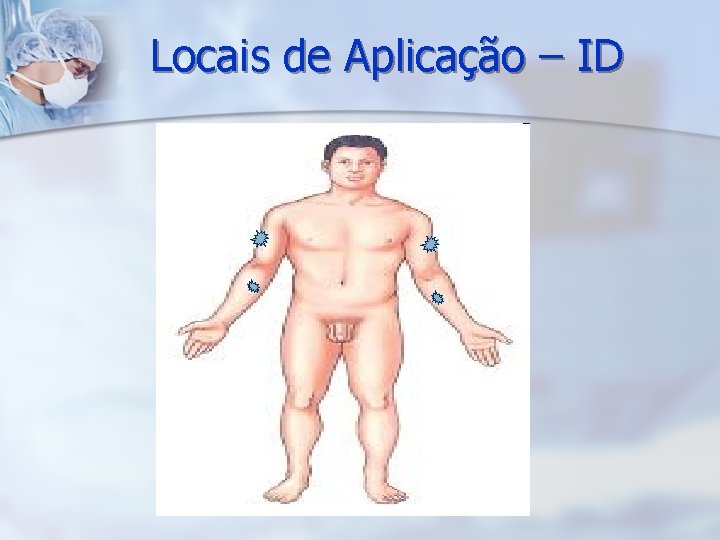 Locais de Aplicação – ID 
