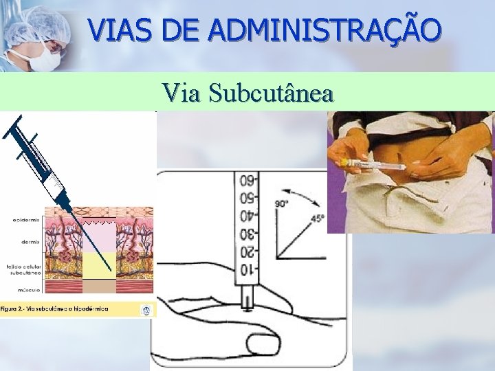VIAS DE ADMINISTRAÇÃO Via Subcutânea 