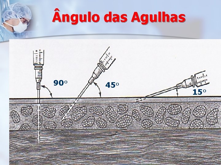  ngulo das Agulhas 90 o 45 o 15 o 