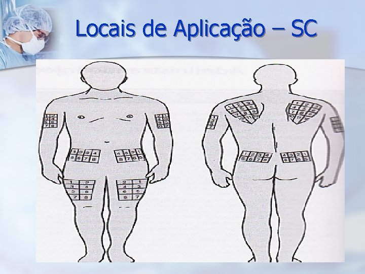Locais de Aplicação – SC 