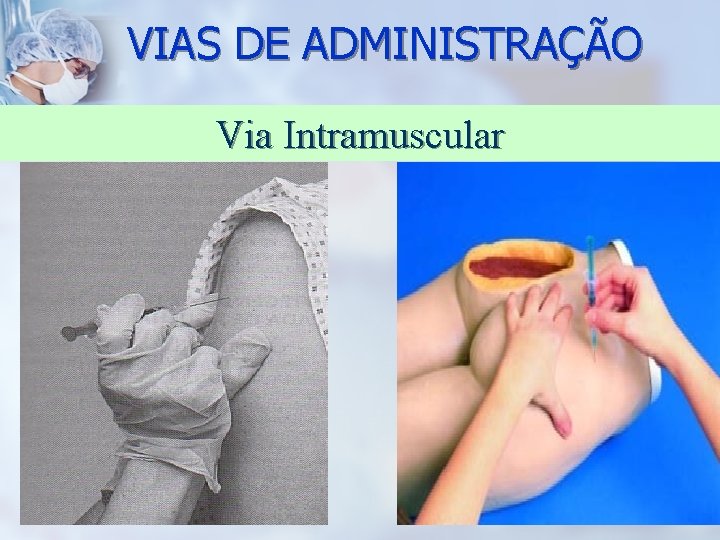 VIAS DE ADMINISTRAÇÃO Via Intramuscular 