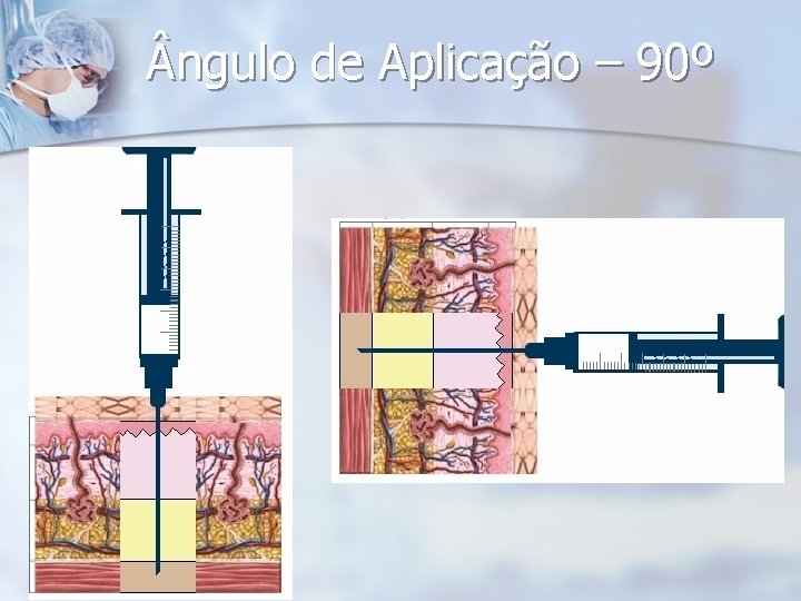  ngulo de Aplicação – 90º 
