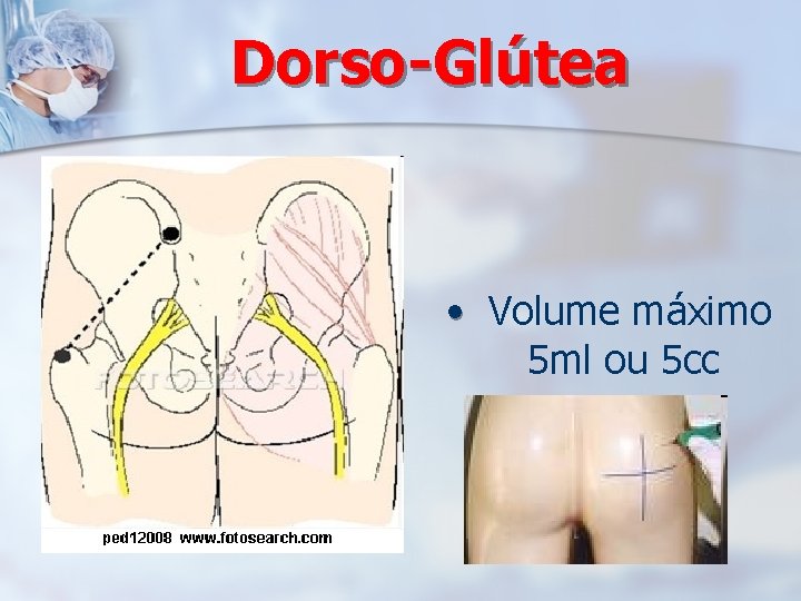 Dorso-Glútea • Volume máximo 5 ml ou 5 cc 