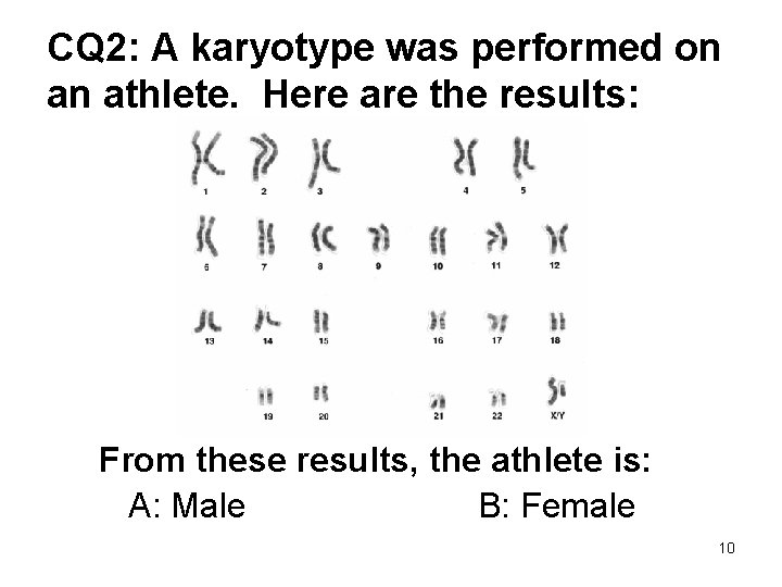 CQ 2: A karyotype was performed on an athlete. Here are the results: From