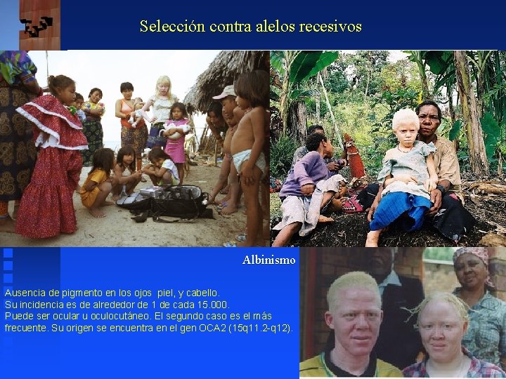 Selección contra alelos recesivos Albinismo Ausencia de pigmento en los ojos piel, y cabello. Selección contra alelos recesivos Albinismo Ausencia de pigmento en los ojos piel, y cabello.