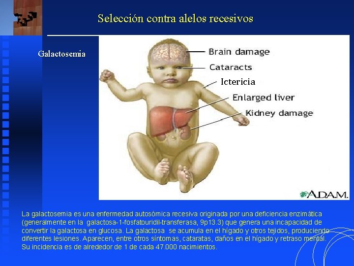 Selección contra alelos recesivos Galactosemia Ictericia La galactosemia es una enfermedad autosómica recesiva originada Selección contra alelos recesivos Galactosemia Ictericia La galactosemia es una enfermedad autosómica recesiva originada