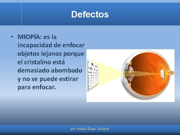 Defectos • MIOPÍA: es la incapacidad de enfocar objetos lejanos porque el cristalino está