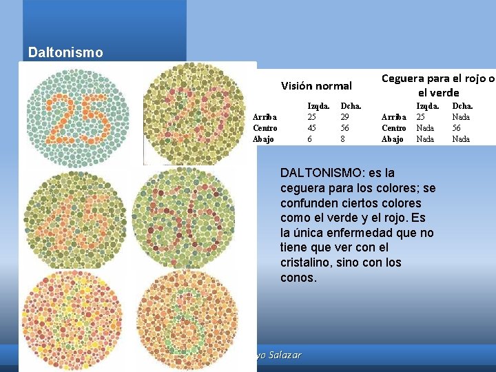 Daltonismo Visión normal Izqda. 25 45 6 Arriba Centro Abajo Dcha. 29 56 8