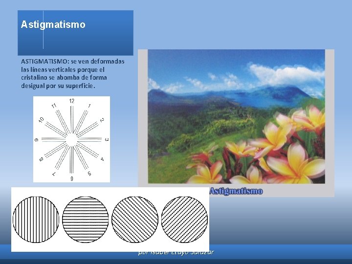 Astigmatismo ASTIGMATISMO: se ven deformadas líneas verticales porque el cristalino se abomba de forma