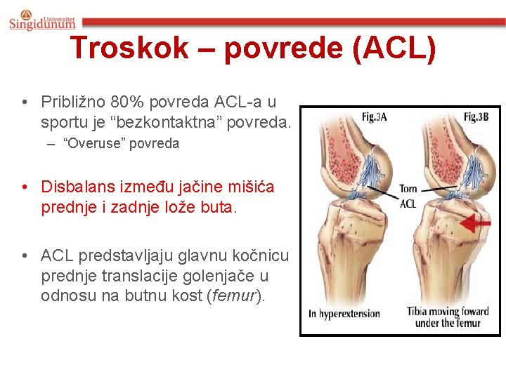 Troskok – povrede (ACL) • Približno 80% povreda ACL-a u sportu je “bezkontaktna” povreda.