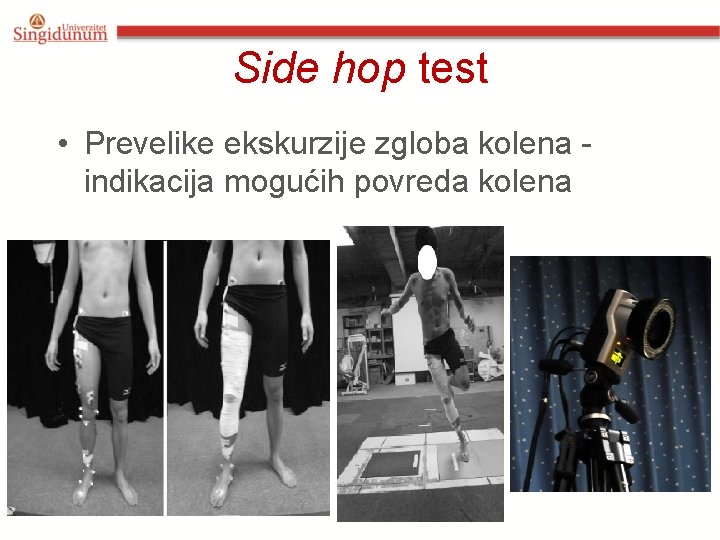 Side hop test • Prevelike ekskurzije zgloba kolena indikacija mogućih povreda kolena 