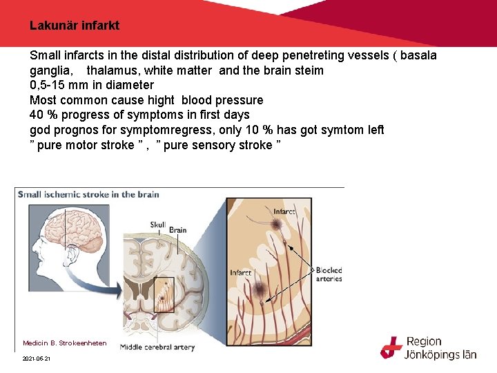 Lakunär infarkt Small infarcts in the distal distribution of deep penetreting vessels ( basala Lakunär infarkt Small infarcts in the distal distribution of deep penetreting vessels ( basala