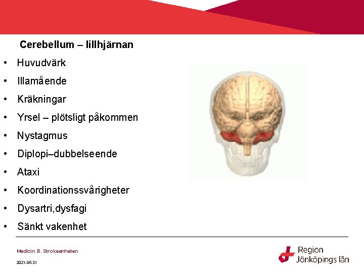 Cerebellum – lillhjärnan • Huvudvärk • Illamående • Kräkningar • Yrsel – plötsligt påkommen Cerebellum – lillhjärnan • Huvudvärk • Illamående • Kräkningar • Yrsel – plötsligt påkommen