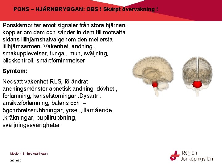 PONS – HJÄRNBRYGGAN: OBS ! Skärpt övervakning ! Ponskärnor tar emot signaler från stora PONS – HJÄRNBRYGGAN: OBS ! Skärpt övervakning ! Ponskärnor tar emot signaler från stora