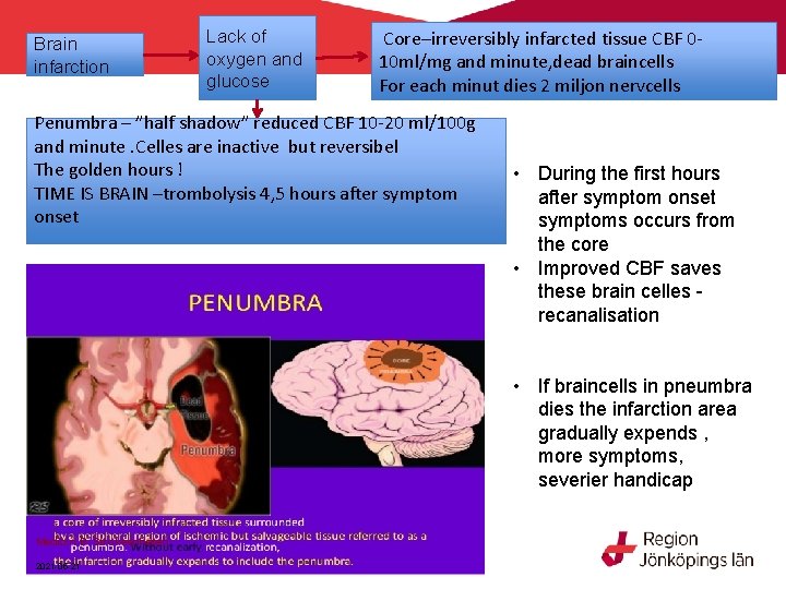 Brain infarction Lack of oxygen and glucose Core–irreversibly infarcted tissue CBF 010 ml/mg and Brain infarction Lack of oxygen and glucose Core–irreversibly infarcted tissue CBF 010 ml/mg and