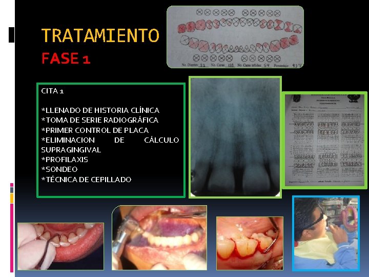 TRATAMIENTO FASE 1 CITA 1 *LLENADO DE HISTORIA CLÍNICA *TOMA DE SERIE RADIOGRÁFICA *PRIMER