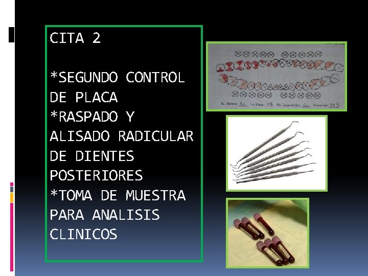 CITA 2 *SEGUNDO CONTROL DE PLACA *RASPADO Y ALISADO RADICULAR DE DIENTES POSTERIORES *TOMA