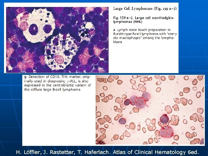 H. Löffler, J. Rastetter, T. Haferlach. Atlas of Clinical Hematology 6 ed. 