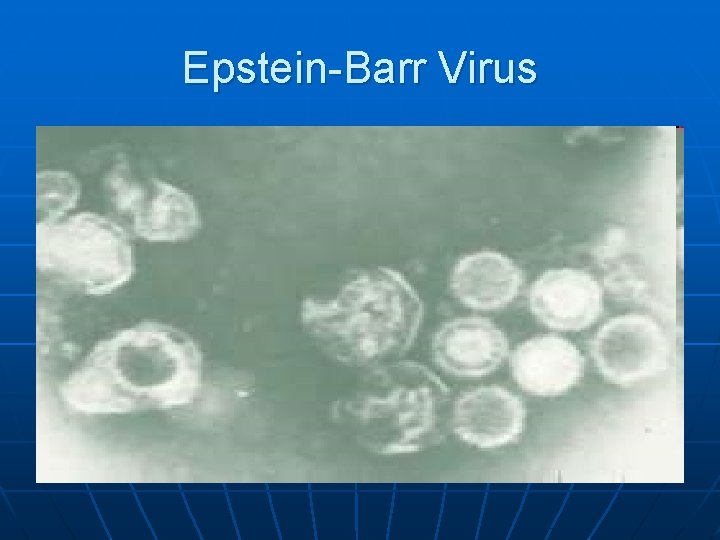 Epstein-Barr Virus 