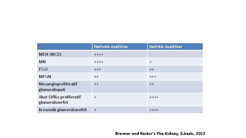 Nefrotik özellikler Nefritik özellikler MDH (MCD) ++++ - MN ++++ + FSGS +++ ++