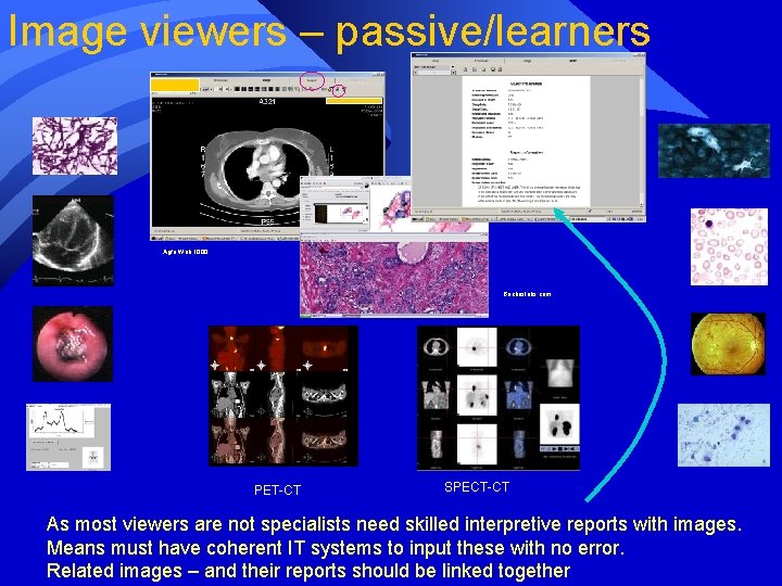 Image viewers – passive/learners Agfa Web 1000 Bachuslabs. com PET-CT SPECT-CT As most viewers