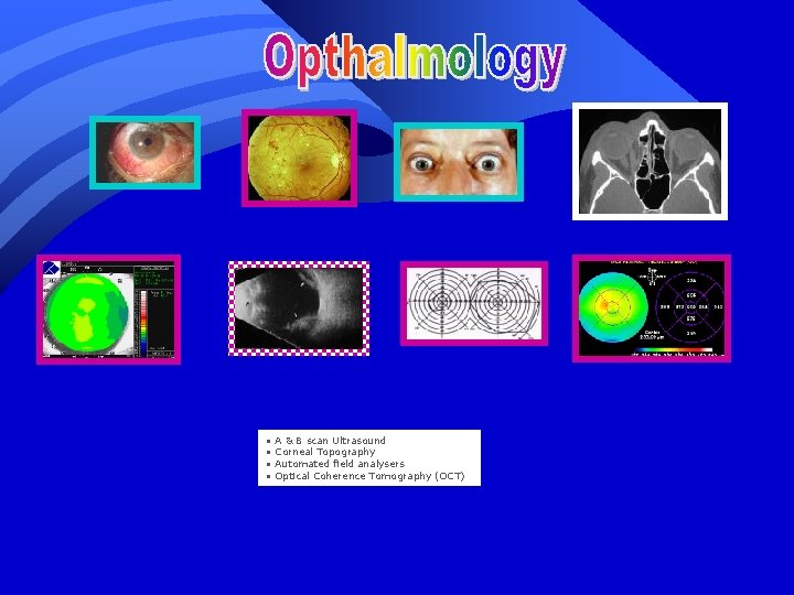  • • A & B scan Ultrasound Corneal Topography Automated field analysers Optical