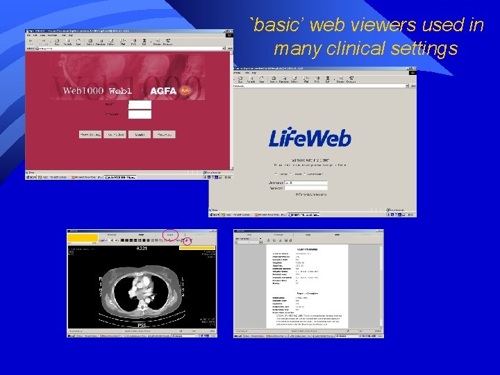 `basic’ web viewers used in many clinical settings 