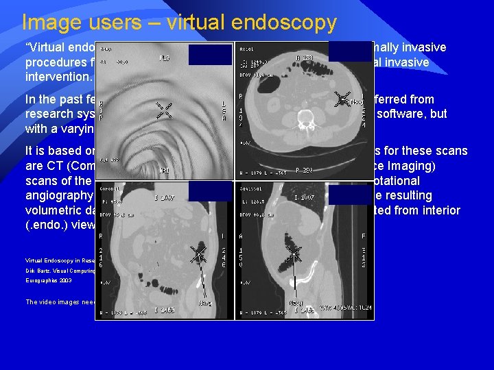 Image users – virtual endoscopy “Virtual endoscopy focuses on the virtual representation of minimally