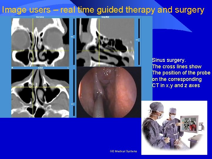 Image users – real time guided therapy and surgery Sinus surgery. The cross lines