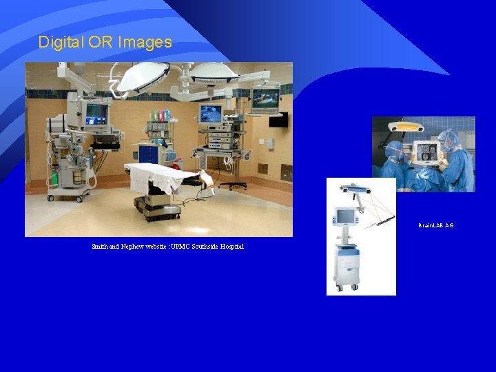 Digital OR Images Brain. LAB AG Smith and Nephew website : UPMC Southside Hospital